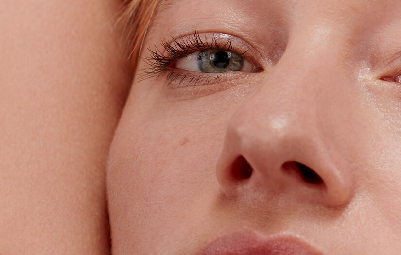 Shed Some Light On Dark Circles