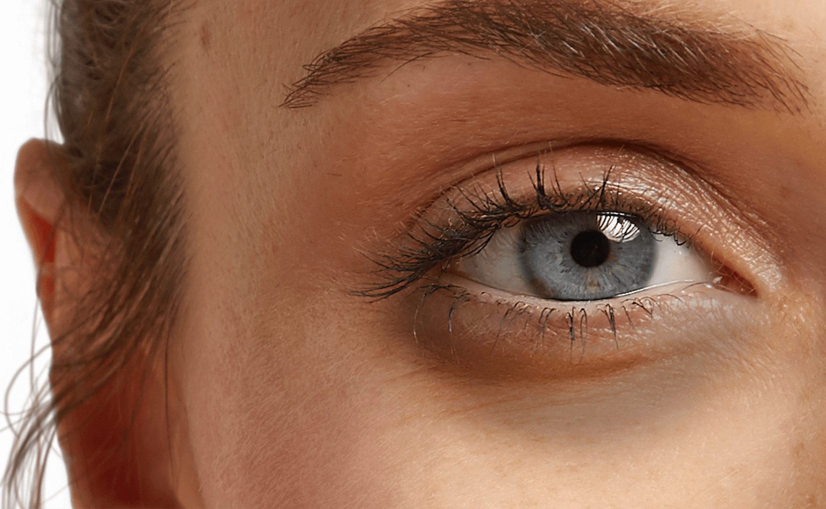 Shed Some Light On Dark Circles Shed Some Light On Dark Circles